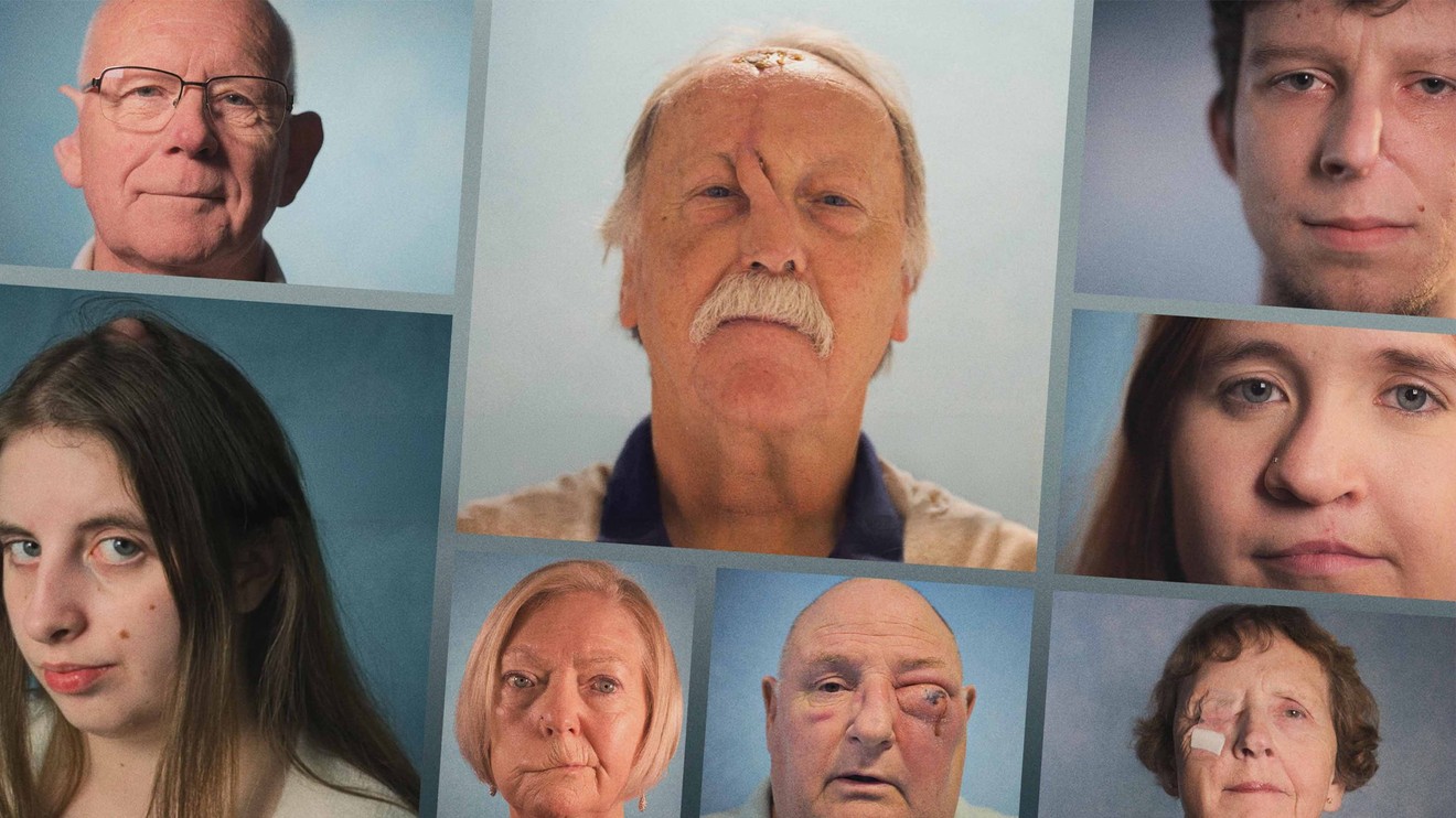 Obličejová chirurgie