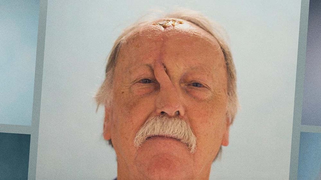 Obličejová chirurgie