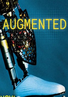 Robotické protézy - nová naděje