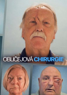 Obličejová chirurgie